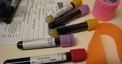 Good and bad aspects of Phlebotomy