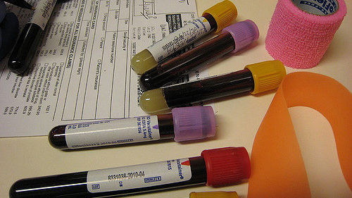 Good and bad aspects of Phlebotomy
